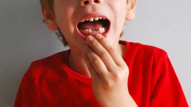 Imagen de archivo de un niño al que se le han caído los dientes.